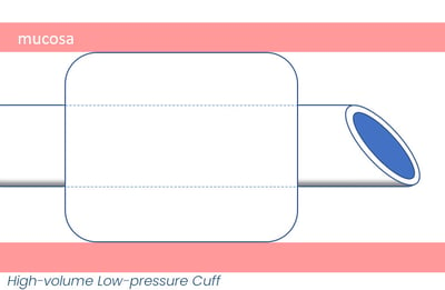 High-Volume-Low-Pressure-cuff