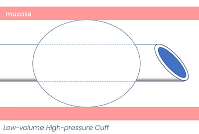 Low-Volume-High-Pressure-Cuff_2