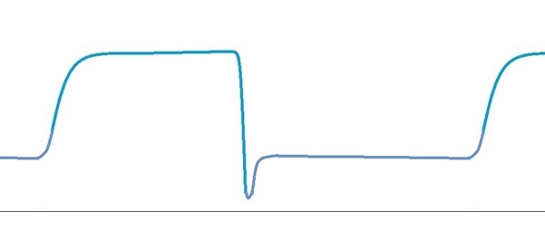 Low-Flow Anaesthesia. How to safely reduce volatile agent & oxygen usage